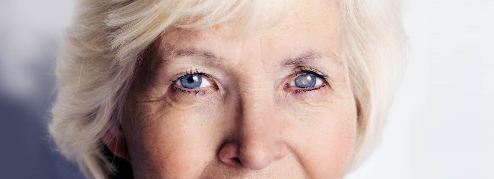 Cataract Surgery in Canyon Lakes At Stonegate